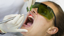 Zahnarzt behandelt Zhne mit dem Laser